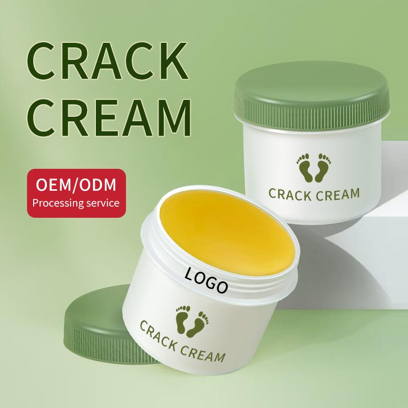 Foot Cream for Cracked Heels